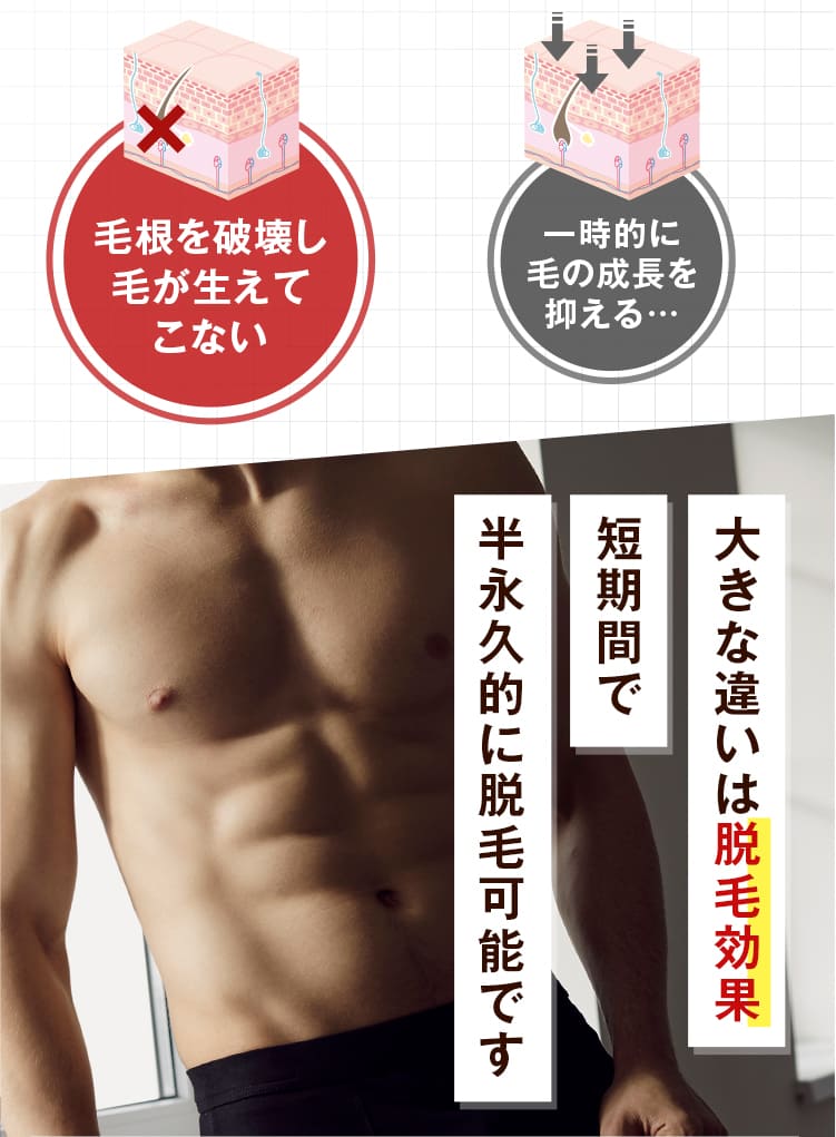 大きな違いは脱毛効果