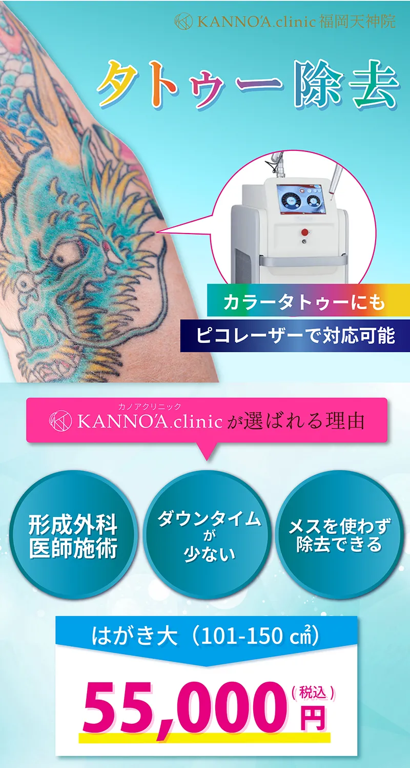 選ばれるタトゥー除去？