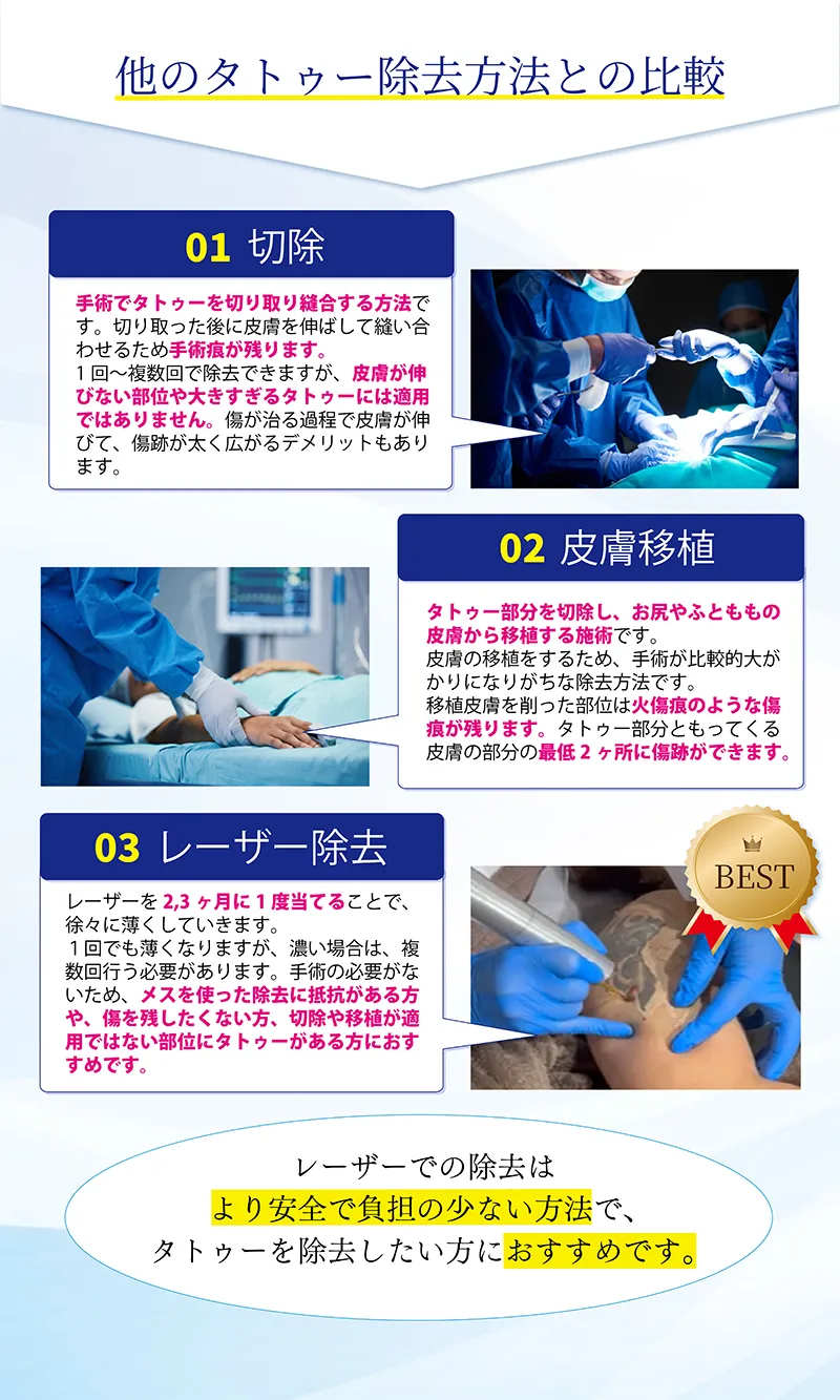 他のタトゥー除去方法との比較？